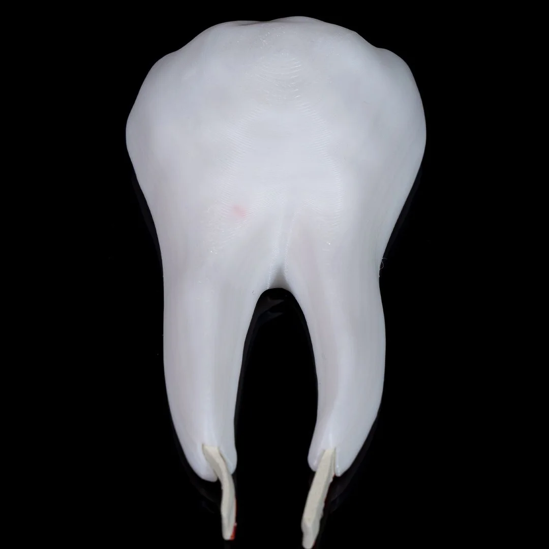 Outer view of the removable tooth model showing the crown and roots.