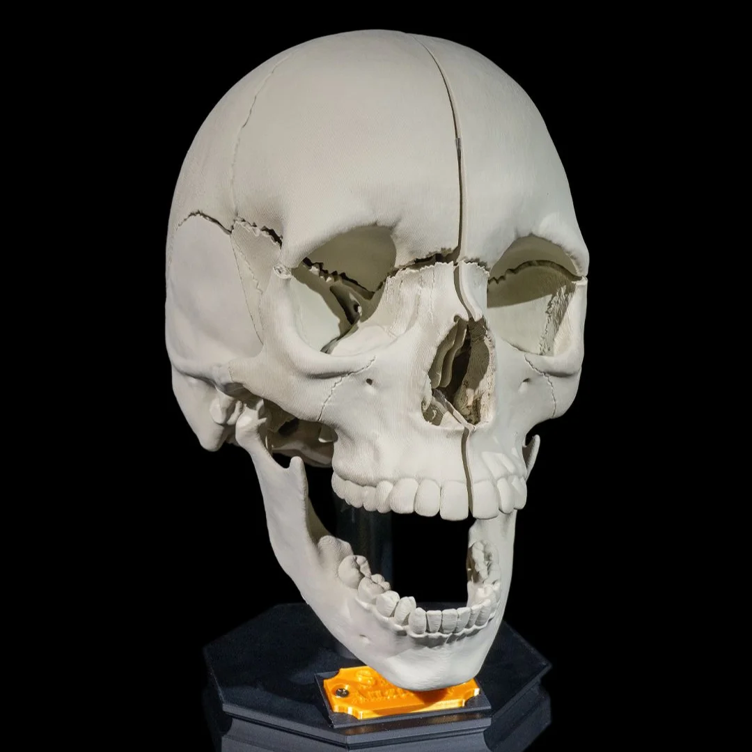 Front angled view of an adult skull model with an open jaw on a stand.