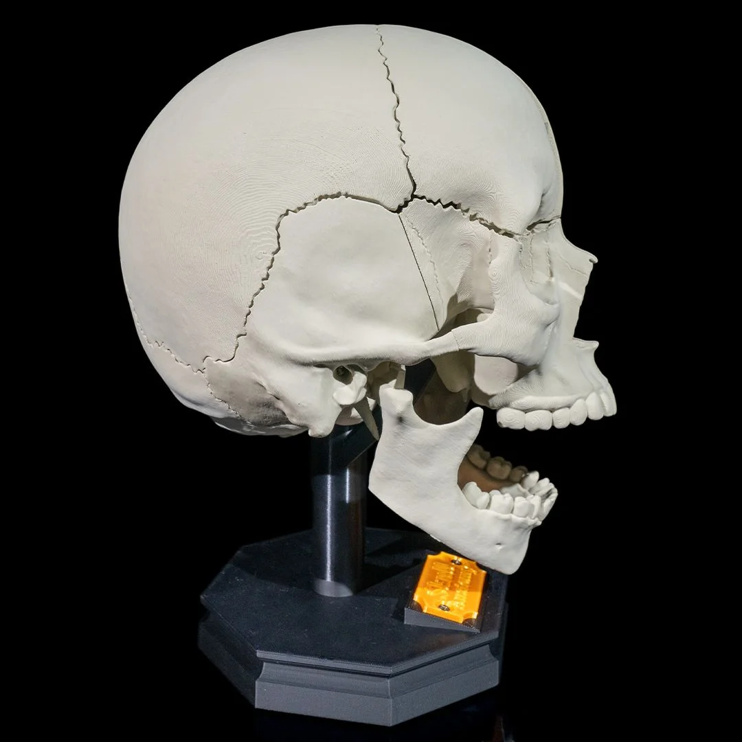 Side view of an adult skull model with an open jaw.