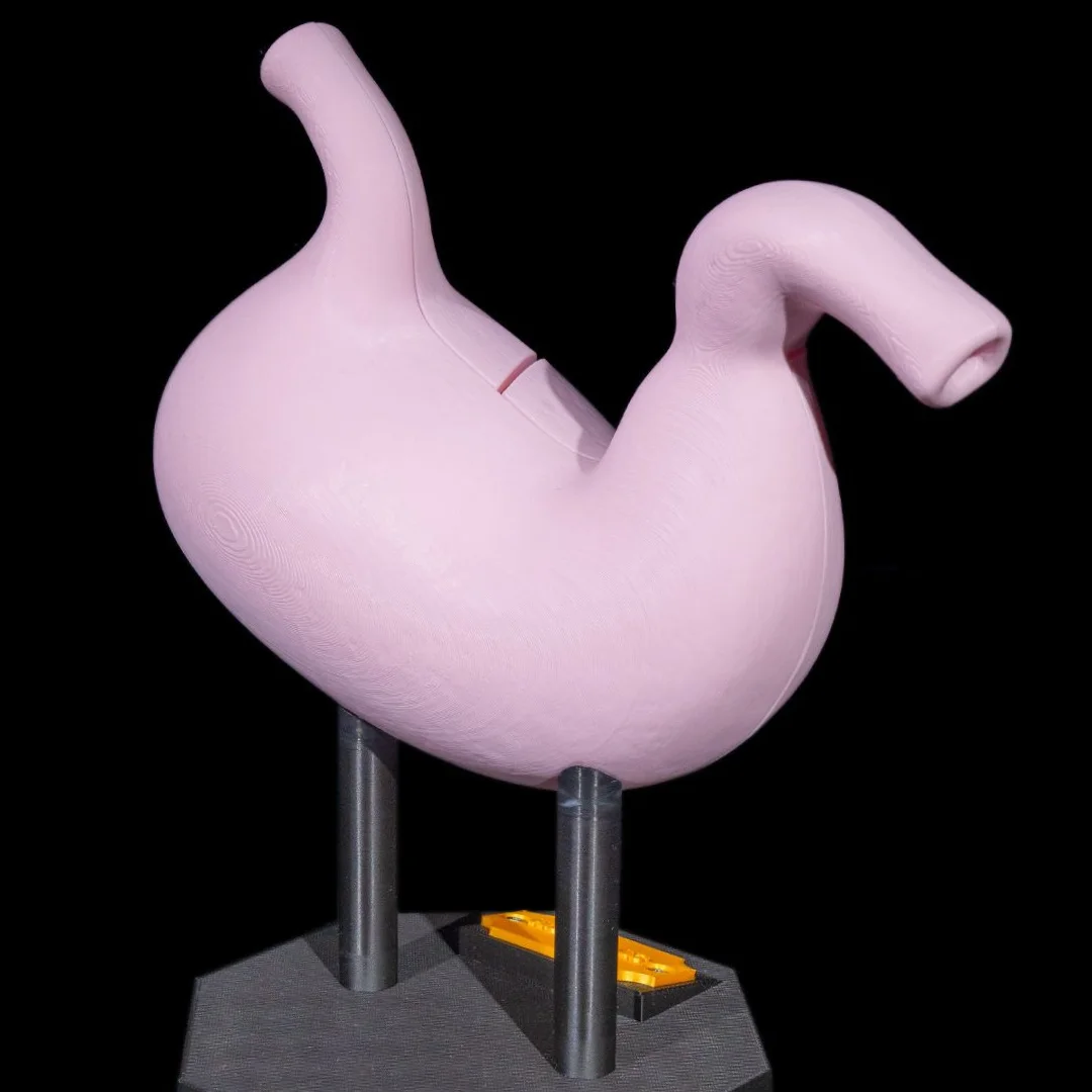 Opposite rear angle of an assembled stomach model.