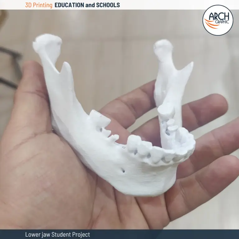 نموذج الفك السفلي مطبوع بتقنية الطباعة ثلاثية الأبعاد