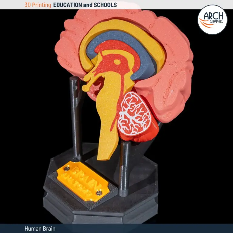 Anatomical human brain model with internal structures and color-coded parts.