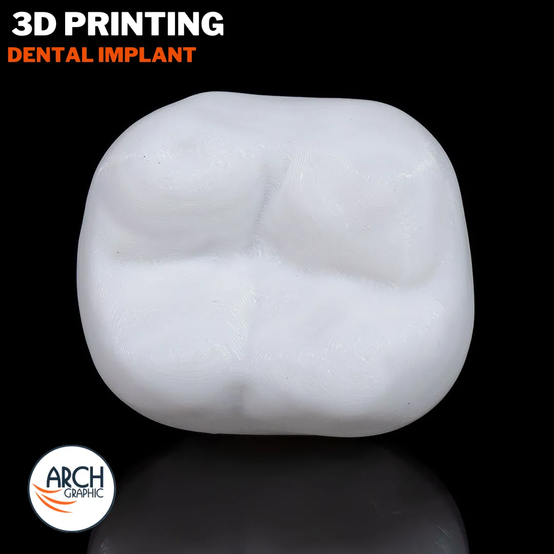 3D printed dental implant training model for clinics, universities, and professional workshops in UAE