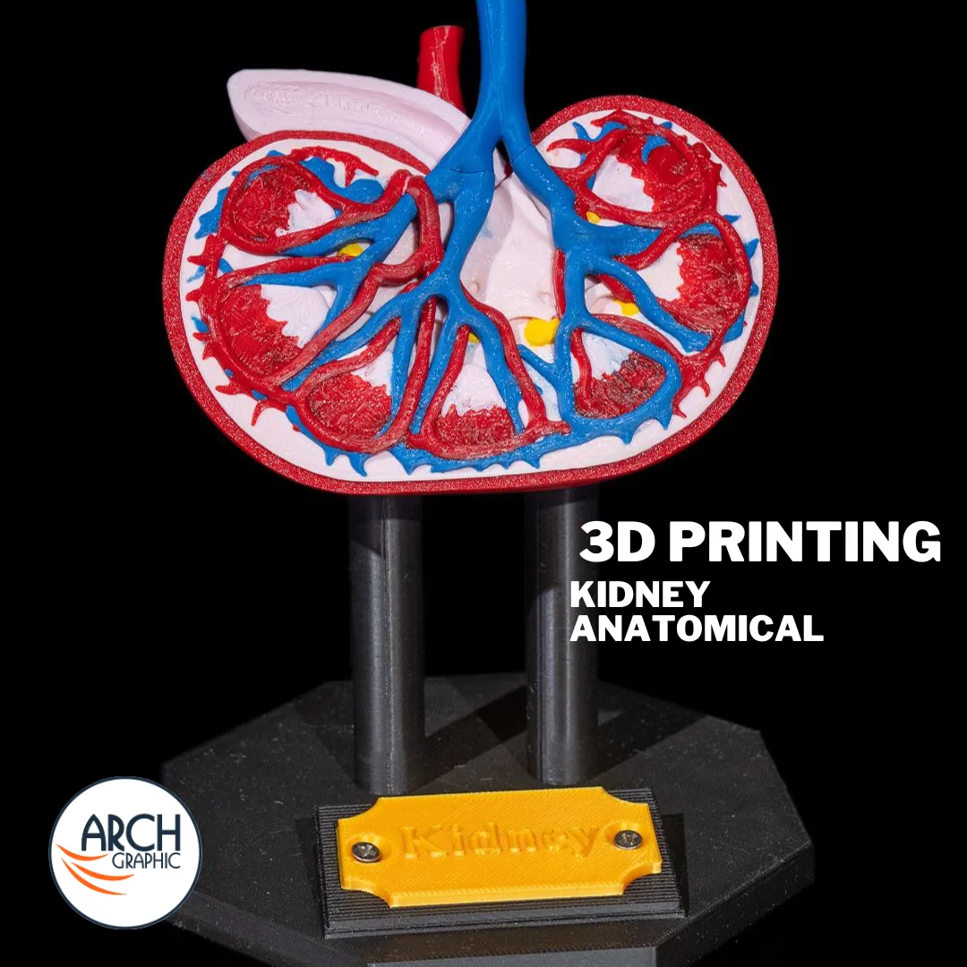 3D printed kidney anatomical model for medical education and school projects in UAE