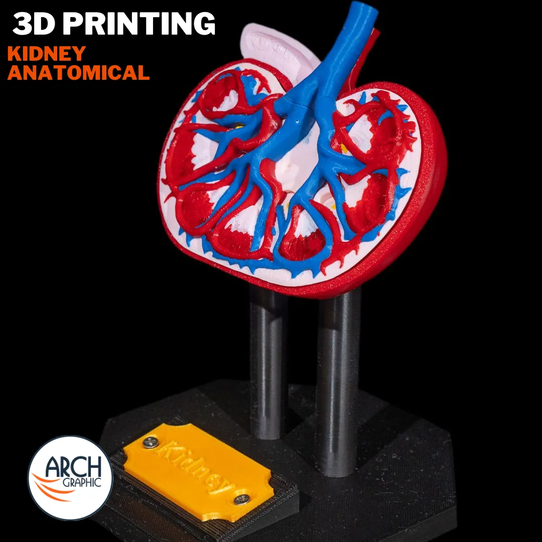 3D printed anatomical model of the human kidney for medical training in UAE and Sharjah
