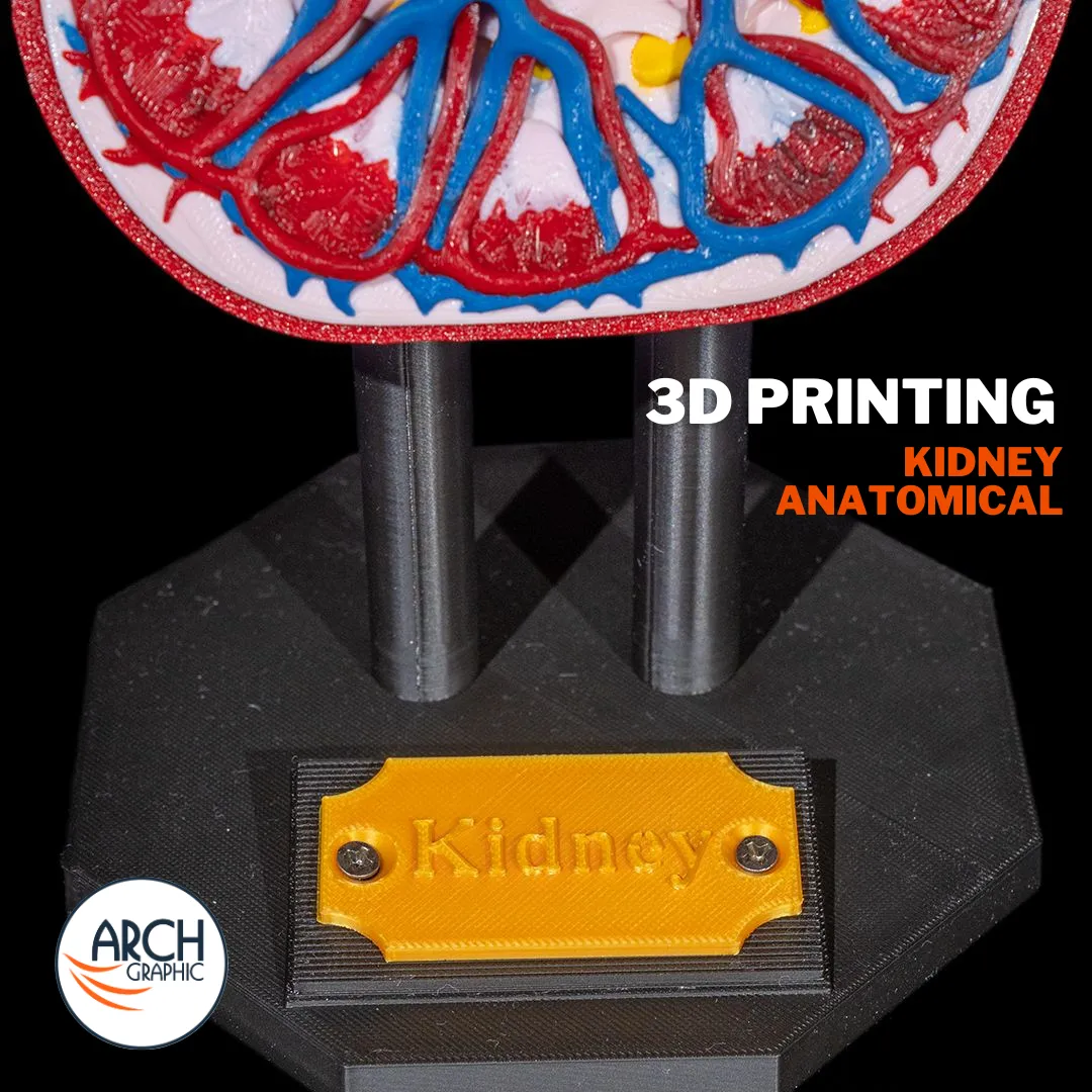 3D printed kidney medical model designed for university training and professional workshops in UAE