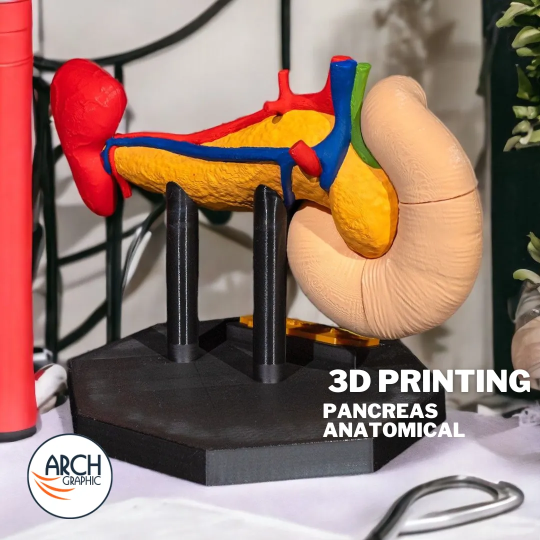 3D printed pancreas medical model designed for university training and professional workshops in UAE